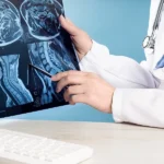 Doctor pointing at brain and neck x-rays