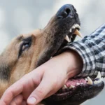 Dog biting person's forearm